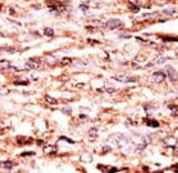 Polyclonal Rabbit anti-Human JUN / c-Jun Antibody (phospho-Ser63, IHC, WB)