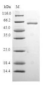 Human QKI Protein (Recombinant GST, N-terminus)