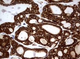 NME1 / NM23 Antibody (clone OTI7D6)