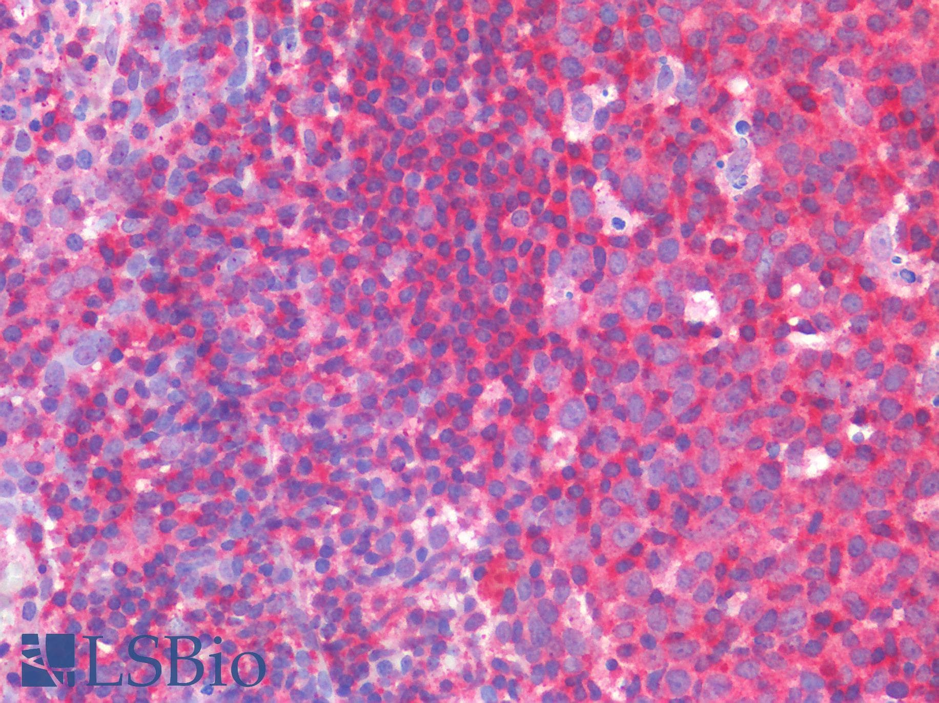 IHC-plus™ IL3RA / CD123 Antibody