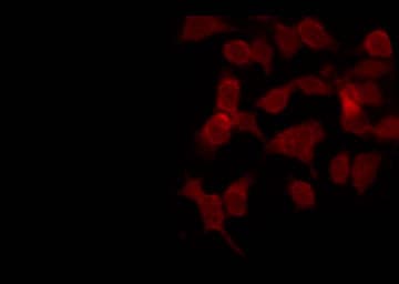 Polyclonal Rabbit anti-Human PLCG1 Antibody (IHC, IF, WB)