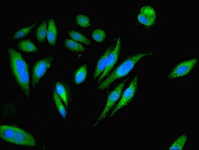Polyclonal Rabbit anti-Human PEA15 / PEA-15 Antibody (IHC, IF, WB)