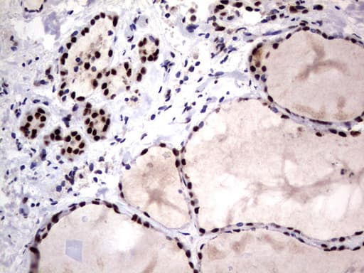 DDX56 Antibody (aa323-547, clone UMAB153)