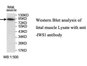 IWS1 Antibody (aa591-743)
