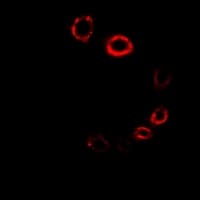 IHC-plus™ HMG-CoA Reductase / HMGCR Antibody