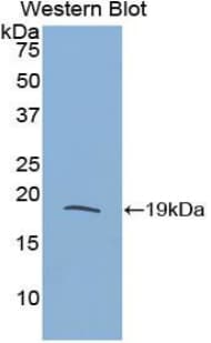 RNASE3 Antibody (aa33-155)