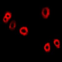 UBCH10 / UBE2C Antibody