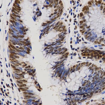 PELP1 Antibody