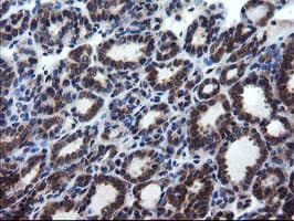 CNOT4 / CLONE243 Antibody (clone OTI1H2)