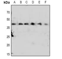Polyclonal Rabbit anti-Human CDK7 Antibody (IHC, WB)