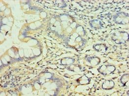 IHC-plus™ ERGIC2 Antibody (aa55-310)