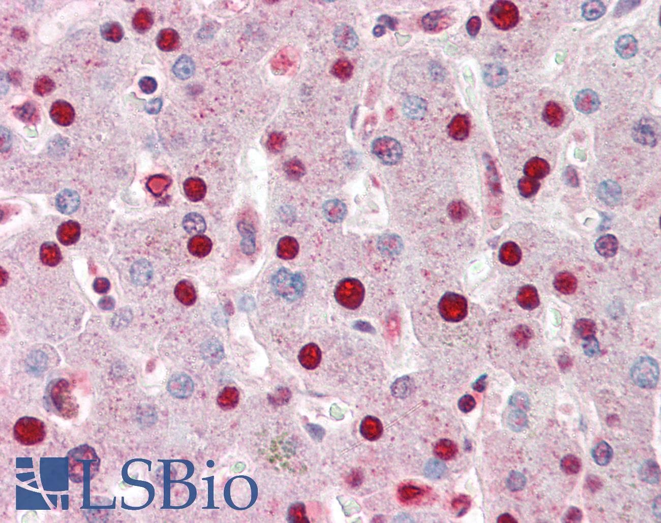 IHC-plus™ PHAP1 / ANP32A Antibody