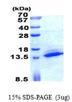 Human SAMD13 Protein (Recombinant His)