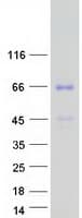 Human PTPRR Protein (Recombinant Myc-DDK (Flag))