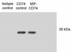 PathPlus™ CD74 / CLIP Antibody (clone PIN.1)