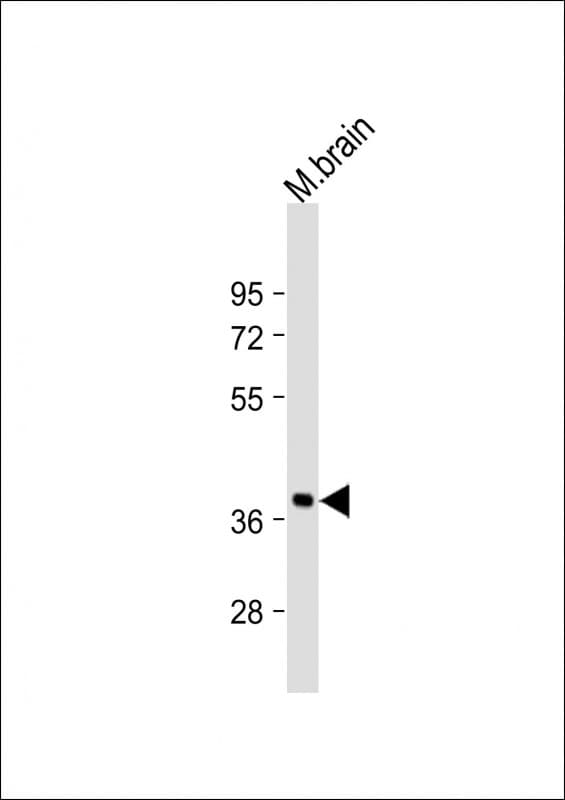 RASSF2 Antibody (aa64-98)