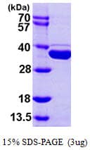 Human METTL1 Protein (Recombinant His)