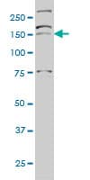 AATK / AATYK Antibody (clone 5B8)