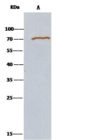METAP2 Antibody (Preservative Free)