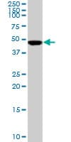 IHC-plus™ Monoclonal Mouse anti-Human SMARCB1 / INI1 Antibody (clone 3E10, IHC, WB)
