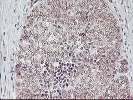 PGAM2 Antibody (clone OTI1C1)