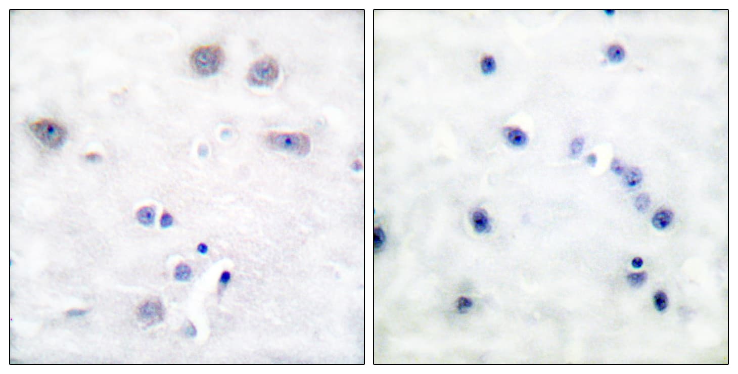 p66 / SHC Antibody (aa393-442)