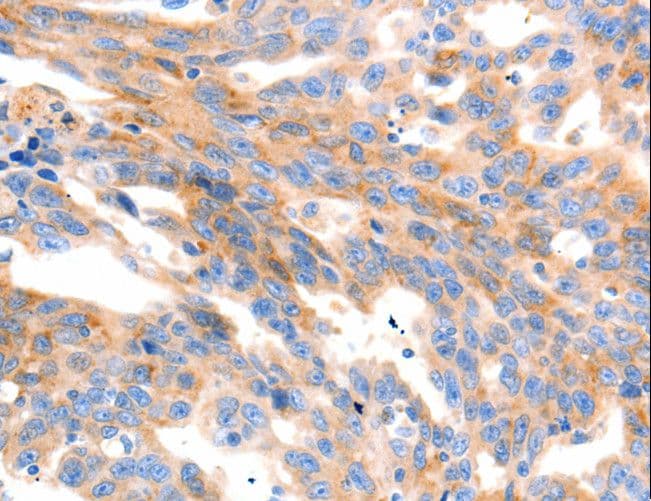 Polyclonal Rabbit anti-Human MAP2K2 / MKK2 / MEK2 Antibody (IHC, WB)