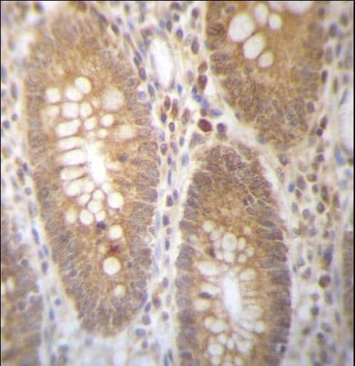 DHRS7B Antibody (aa133-161)