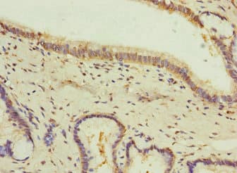 GIPR / GIP Receptor Antibody