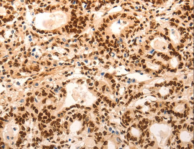 Polyclonal Rabbit anti-Human E2F7 Antibody (IHC)