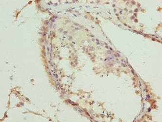 Polyclonal Rabbit anti-Human TRM6 / TRMT6 Antibody (IHC, WB)