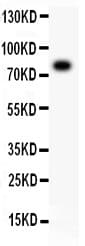 ALOX5 / 5-LOX Antibody (aa120-483)