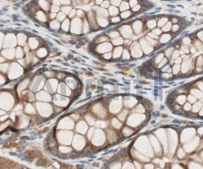 RAB5A / RAB5 Antibody