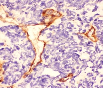 Polyclonal Rabbit anti-Human Laminin Antibody (IHC, WB)
