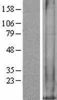 MT1M Protein (Over-Expression Lysate Myc-DDK (Flag))