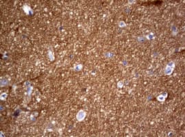 VILIP / VSNL1 Antibody (aa2-191, clone OTI1G10, Carrier-free)