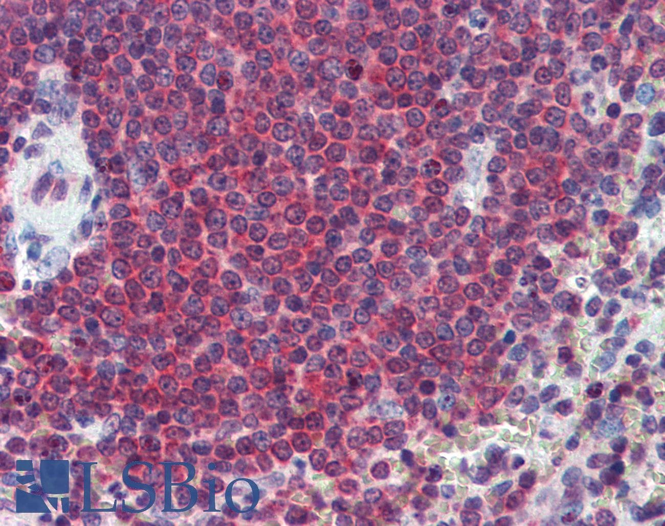 IHC-plus™ CA1 / Carbonic Anhydrase I Antibody (aa166-176)