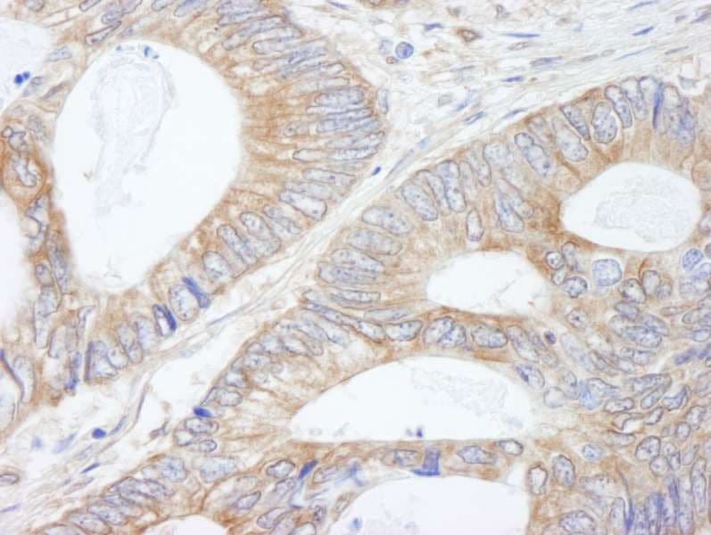 KIAA1524 / p90 Autoantigen Antibody (aa550-600)