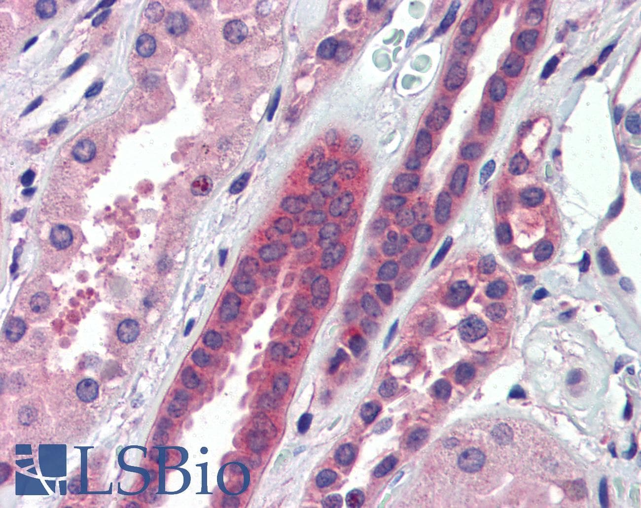 Polyclonal Rabbit anti-Human ATP6V0A2 Antibody (aa72-121, IHC, WB)