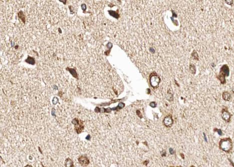 HSP90B1 / GP96 / GRP94 Antibody