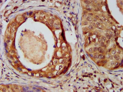 CSMD3 Antibody