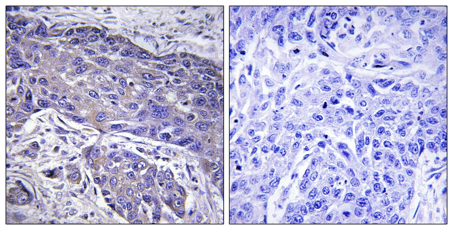 Polyclonal Rabbit anti-Human POFUT1 Antibody (IHC, WB)