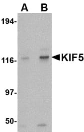 IHC-plus™ Kinesin 5A / KIF5A Antibody