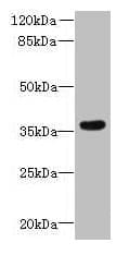 ZDHHC12 Antibody