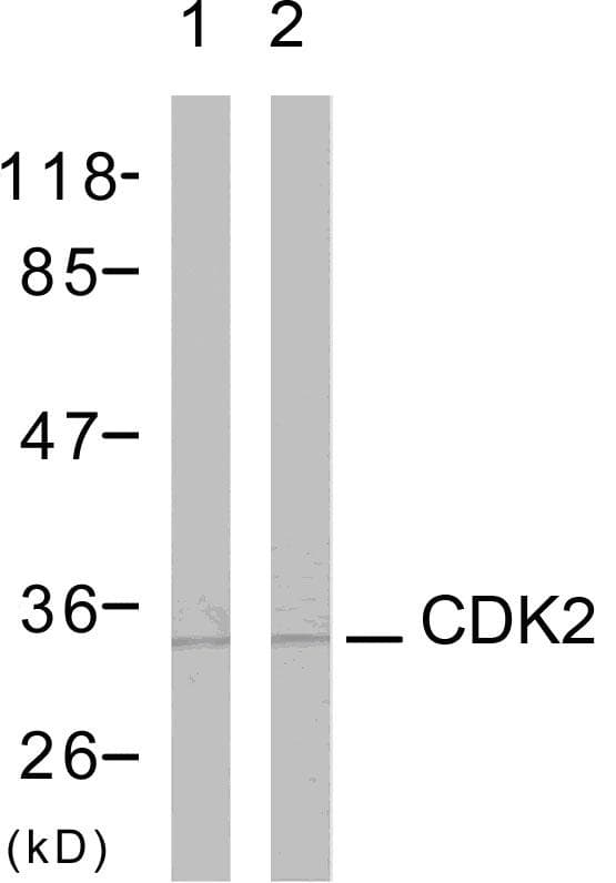 CDK2 Antibody (aa131-180)