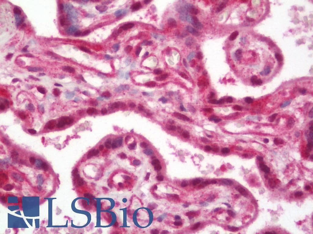 IHC-plus™ TICRR Antibody