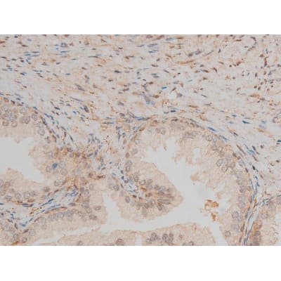 CREB1 / CREB Antibody (phospho-Ser142)