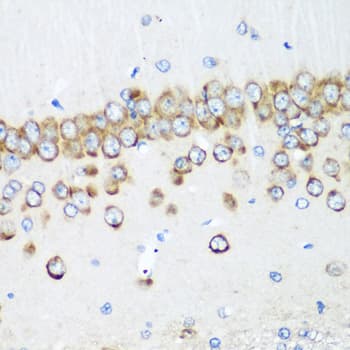 MTDH / Metadherin Antibody