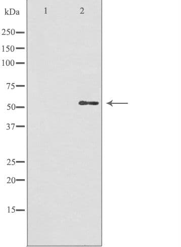 GBA3 / CBG Antibody