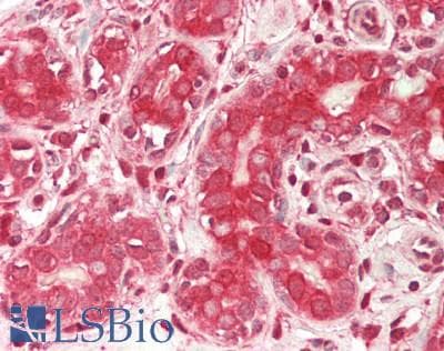 IHC-plus™ LGALS3 / Galectin 3 Antibody (aa2-250)